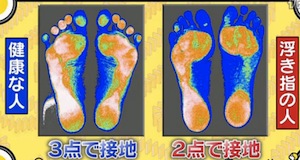 浮き指の改善方法とテーピングのやり方