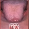 「世界一受けたい授業」舌診(紅舌/溝舌/地図舌/白苔舌/歯根)柿木保明5月12日