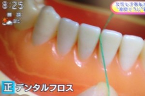 歯間ブラシ/デンタルフロスの正しい使い方＆効果【NHKあさイチ１月１１日】