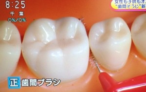 歯間ブラシ/デンタルフロスの正しい使い方＆効果【NHKあさイチ１月１１日】