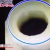 血管若返り物質NO(一酸化窒素)の分泌を増やす【家庭の医学 1月15日】