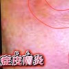 花粉症の原因は乾燥肌?鼻の加湿&粘膜強化方法【世界一受けたい授業 2月2日 石井正則】