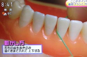 NHKあさイチ 歯周病予防&対策[2月20日 歯間ブラシ/デンタルフロスの使い方,ウスウォッシュ,歯ブラシ]