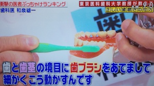 正しい歯磨きの仕方