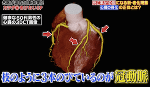 心臓の骨化の画像