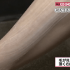 NHKあさイチのムダ毛処理のやり方