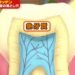 虫歯